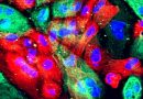 Gut microbes differ in men with prostate cancer